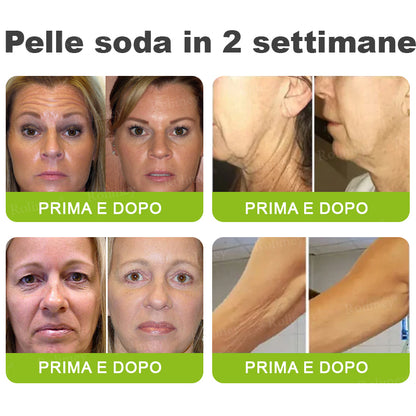 👨🏻‍⚕️ Rolimey® Crema Lifting Antirughe Effetto Botox & Retinolo Vita-A - Ultimo giorno di promozione: 70% di sconto|