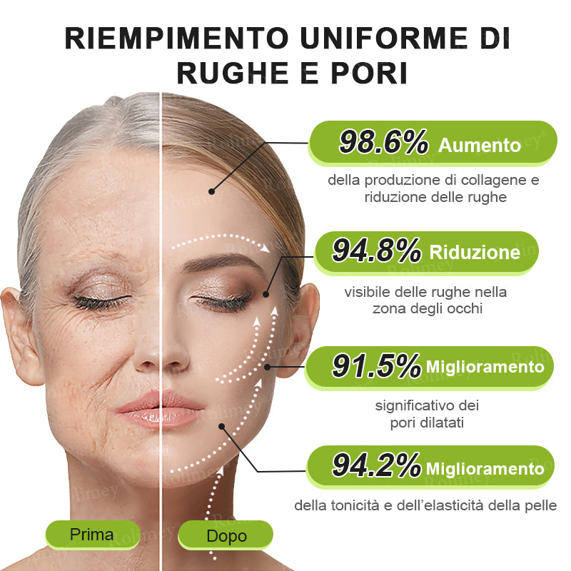👨🏻‍⚕️ Rolimey® Crema Lifting Antirughe Effetto Botox & Retinolo Vita-A - Ultimo giorno di promozione: 70% di sconto|