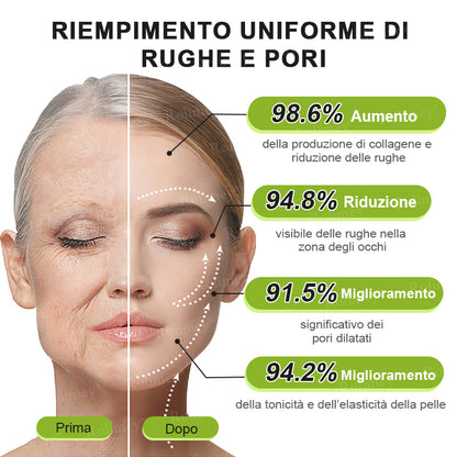 👨🏻‍⚕️ Rolimey® Crema Lifting Antirughe Effetto Botox & Retinolo Vita-A - Ultimo giorno di promozione: 70% di sconto|