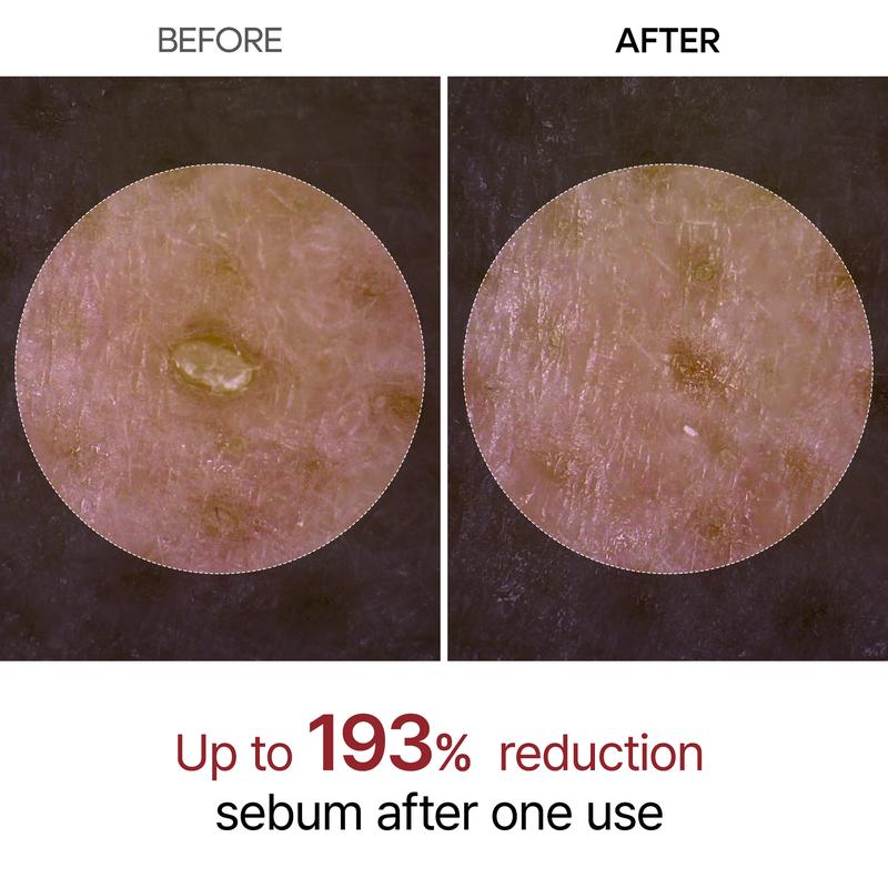 Sieri Illuminanti ed Esfolianti