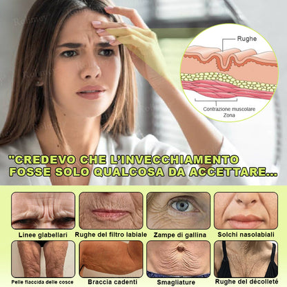 👨🏻‍⚕️ Rolimey® Crema Lifting Antirughe Effetto Botox & Retinolo Vita-A - Ultimo giorno di promozione: 70% di sconto|